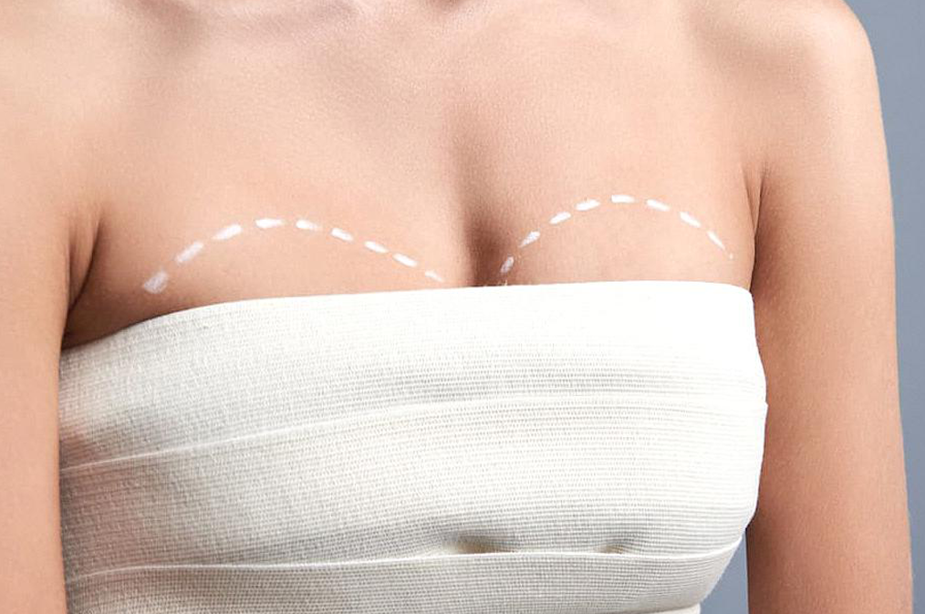 Les seins et votre dos : Pourquoi la taille des seins peut influer sur le mal de dos